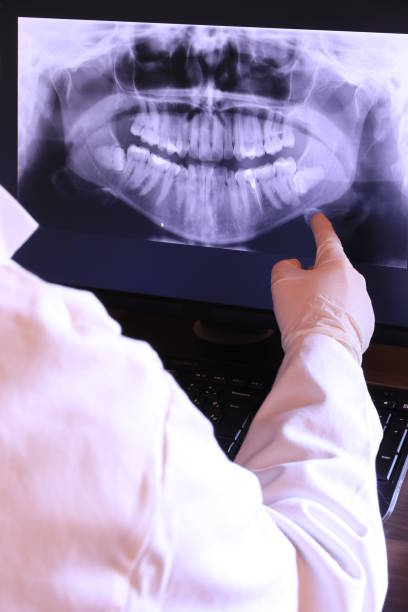 Best Emergency Root Canal Treatment in Webster City, IA