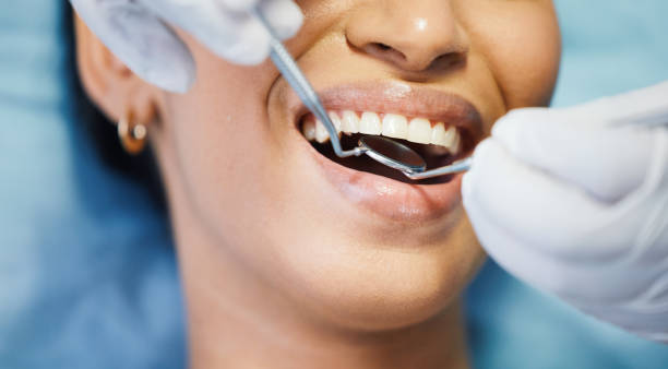 Best Same-Day Emergency Dentist in Webster City, IA
