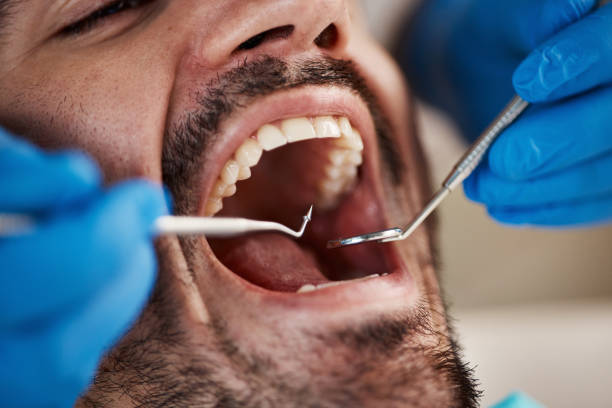 Best Emergency Treatment for Toothache in Webster City, IA